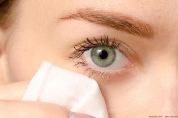 Woman wiping eye with cloth Image credit: AdobeStock/Kabardinsphoto