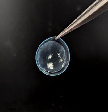 Cam360 AmnioGraft Image credit: BioTissue