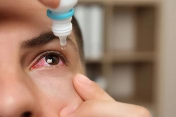 Person administering eye drops in red eye Image credit: AdobeStock/NewAfrica