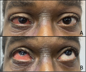 Reviewing a patient’s systemic history is critical when treating for OSD