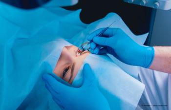 LASIK surgery being performed