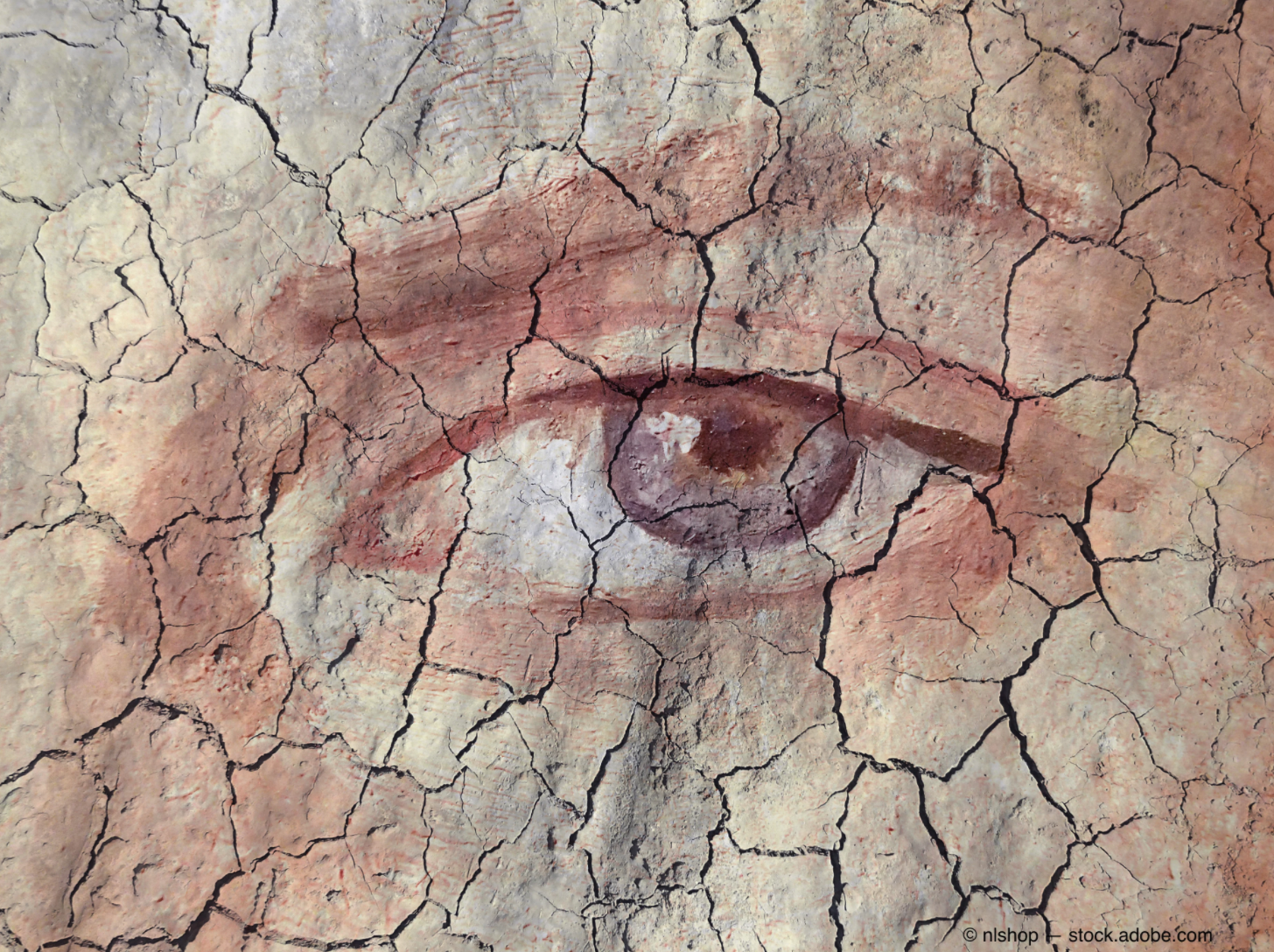 www.optometrytimes.com