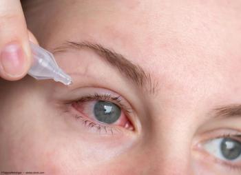 Woman administering eye drops Image credit: AdobeStock/TatjanaMeininger