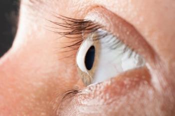 Eye with keratoconus Image credit: AdobeStock/Fukume