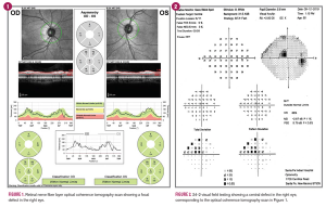 OCT helps diagnose macular pathology