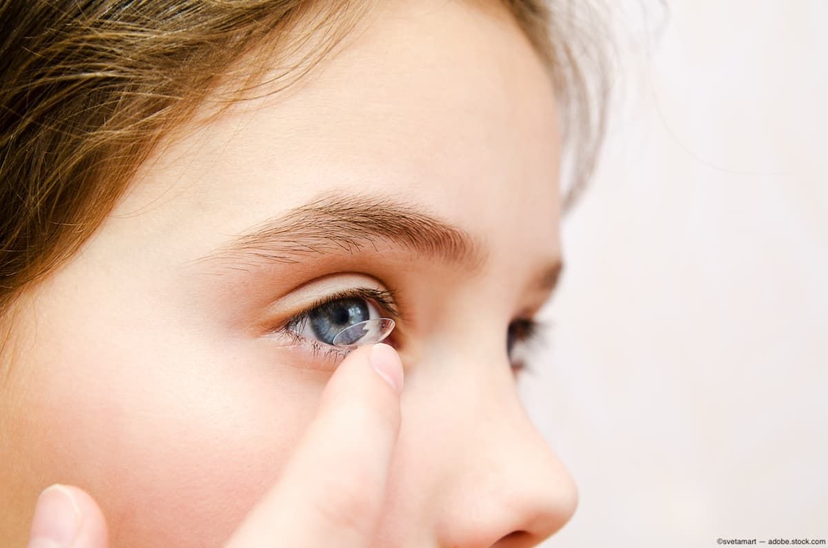 Child administering contact lens Image credit: AdobeStock/svetamart