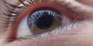 Glaucoma: More pressures than meet the eye