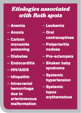 A list of the etiologies associated with Roth Spots