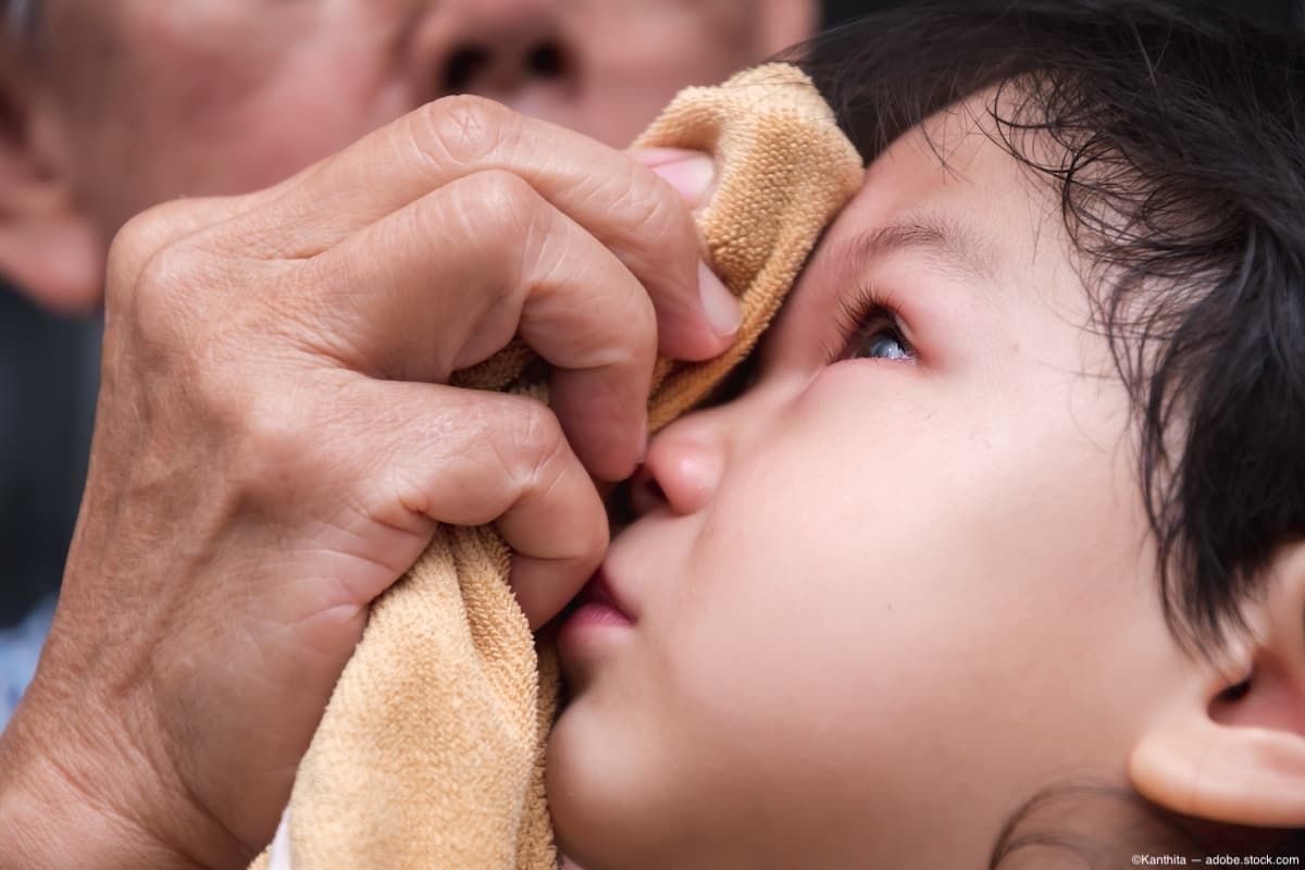 Child with towel on eye Image credit: ©Kanthita - adobe.stock.com