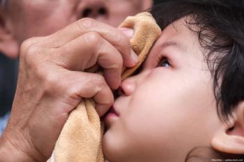 Child with towel on eye Image credit: ©Kanthita - adobe.stock.com