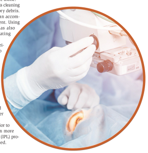 Why ODs should prepare patients for surgery years before they need it