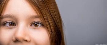 Strabimus in child Image credit: AdobeStock/Yevhen