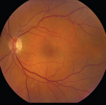 2022 updates to ADA standards of care for patients with diabetes
