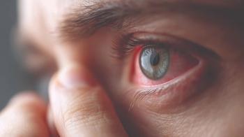 Closeup of irritated eye Image credit: AdobeStock/Anastasiia
