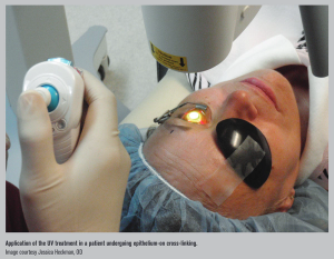 Epi-on cross-linking may speed visual recovery