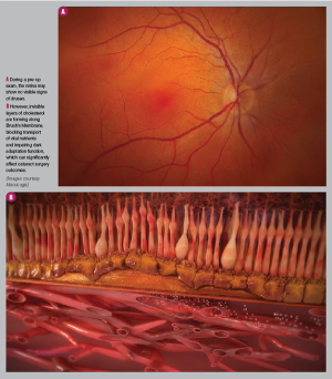 Retina figures a and b