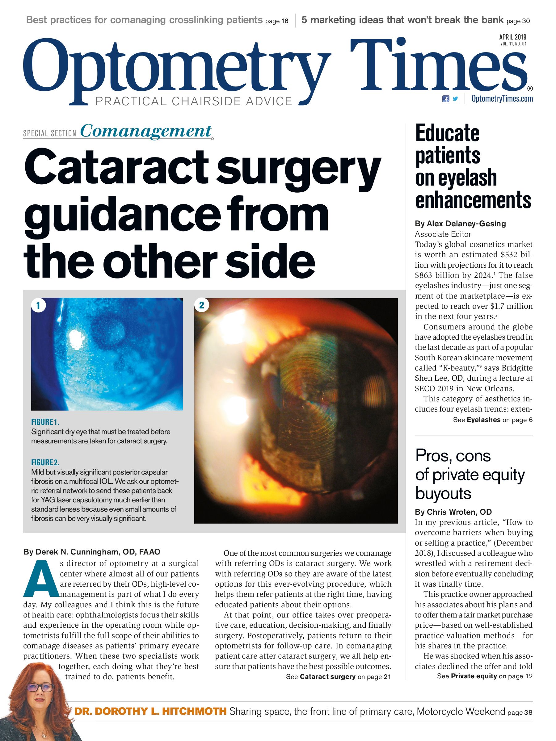 research topics in optometry