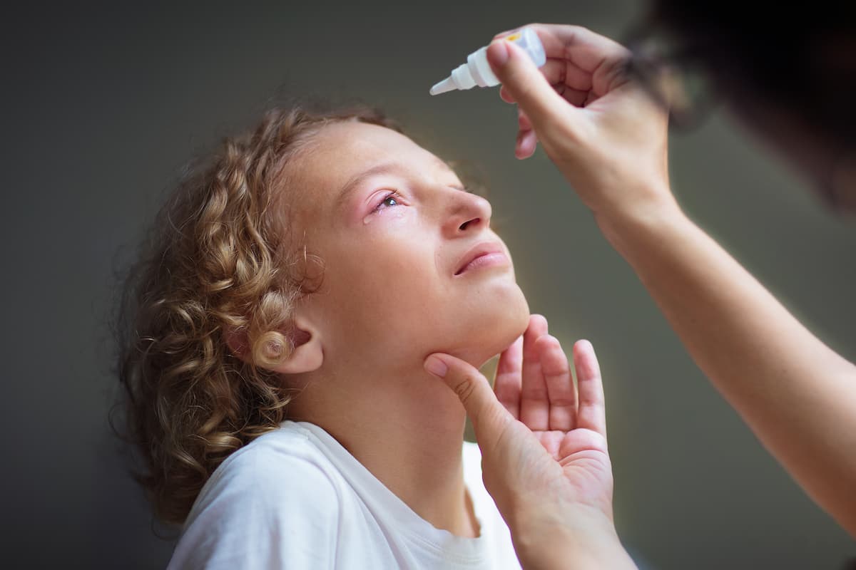 Parent administering eye drop to child Image credit: AdobeStock/famveldman