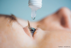 Remember the basics as dry eye treatments expand