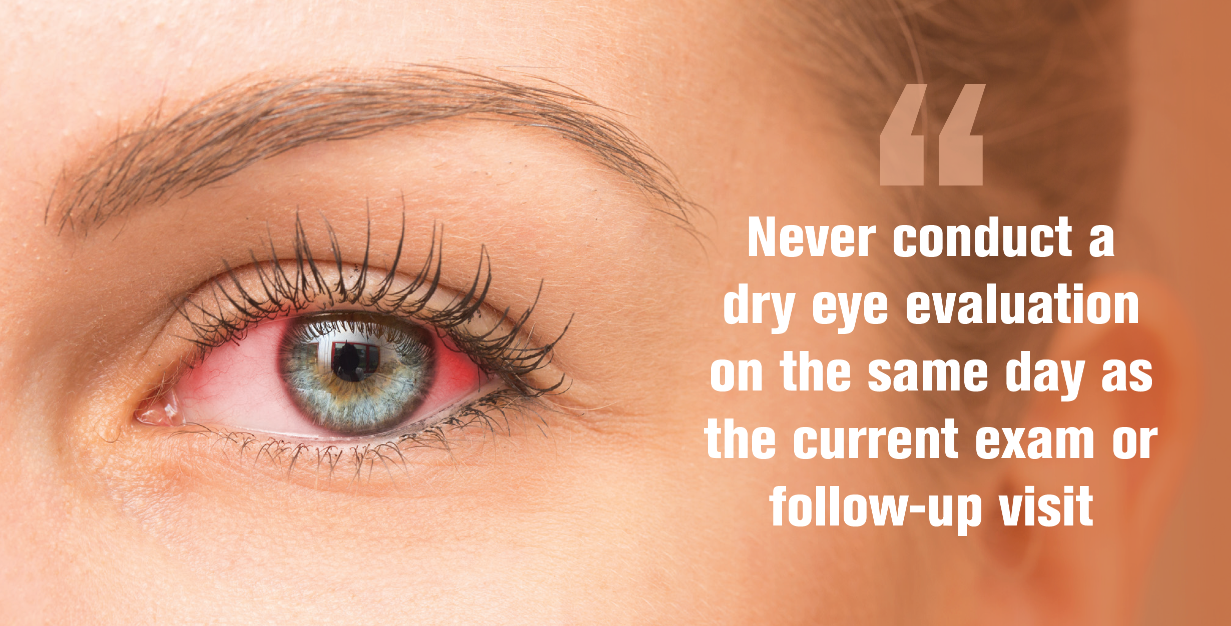 How to treat dry eyes