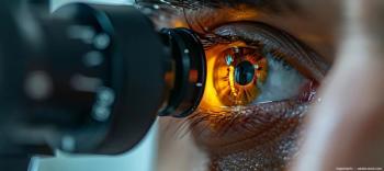 Eye looking through lens for visual acuity test Image credit: ©apichat/ai - adobe.stock.com