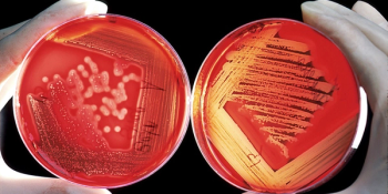 germ culture in dish