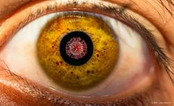 Higher risk of dry eye disease linked to post-COVID-19 patients