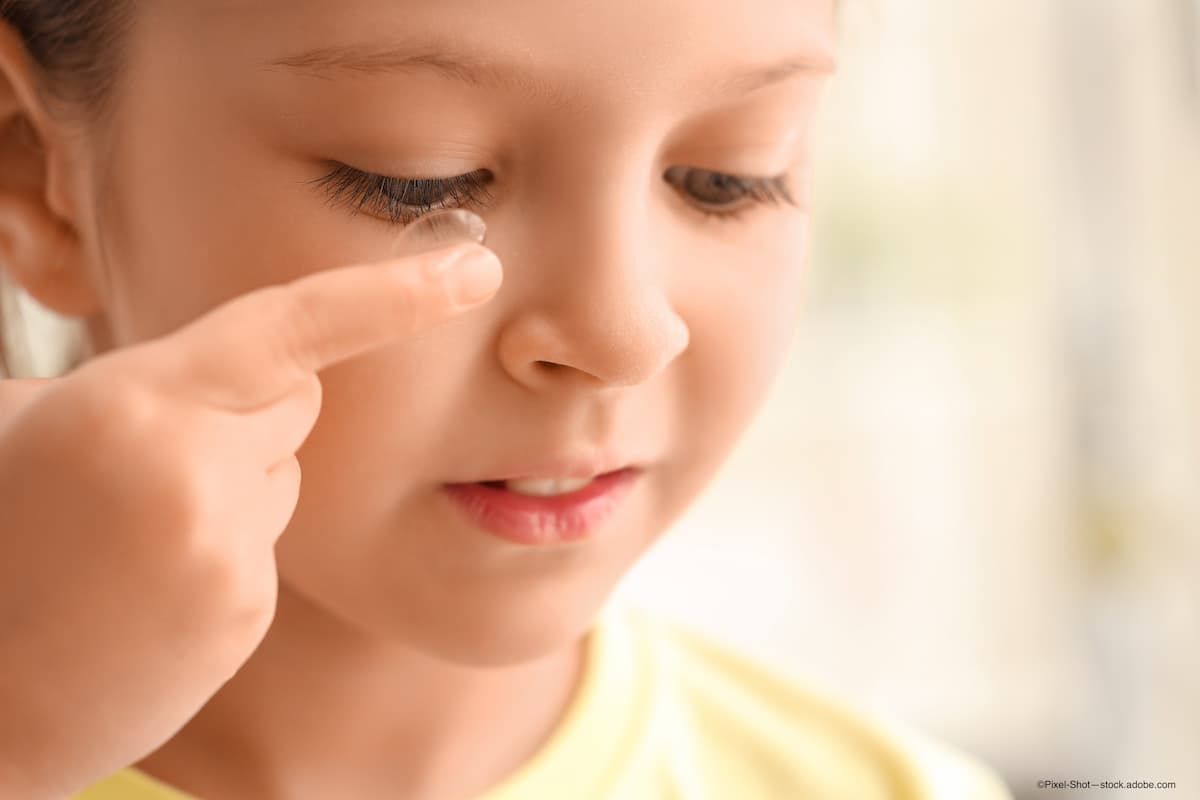 positive effect on myopic eyes following use of multifocal contact lenses, according to BLINK2 study - Image credit: Adobe Stock / ©Pixel-Shot