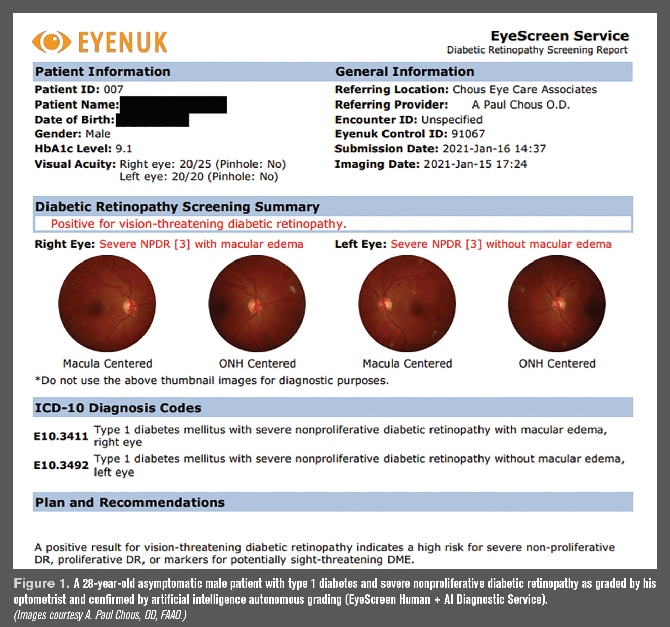 diabetic retinopathy guidelines 2021)