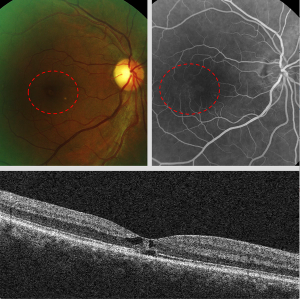  Imaging aids in differential diagnosis of uncommon disease