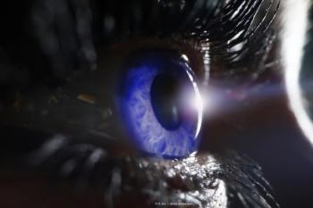 Reducing the burden of drops can improve patients’ QOL and prevent progression of glaucoma.