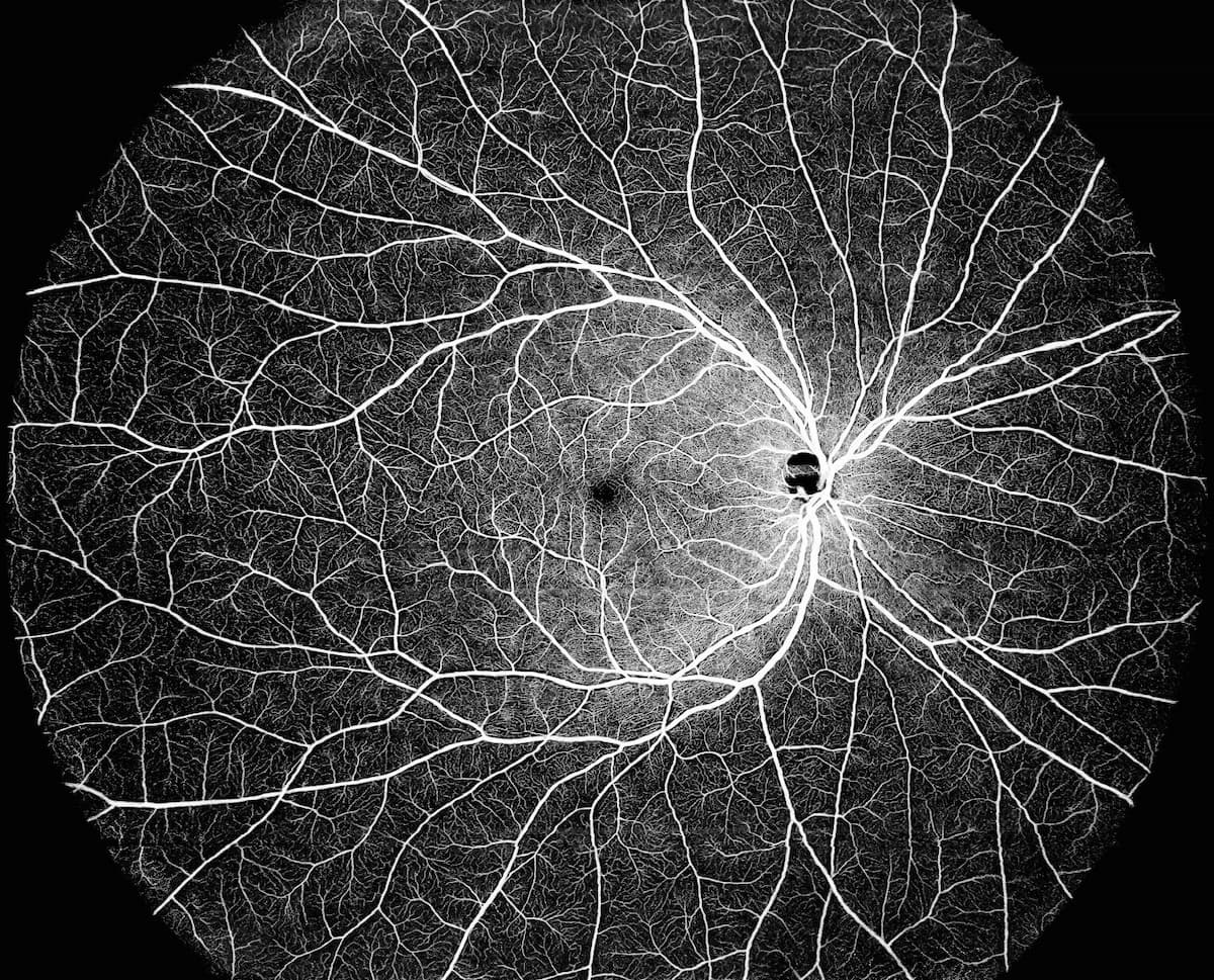 OCT image taken by DREAM OCT device Image credit: Intalight