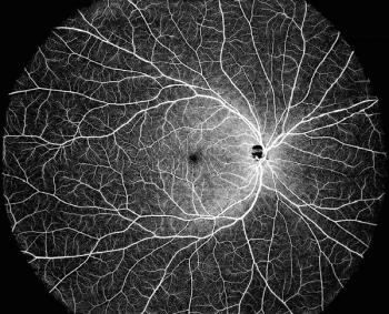 OCT image taken by DREAM OCT device Image credit: Intalight