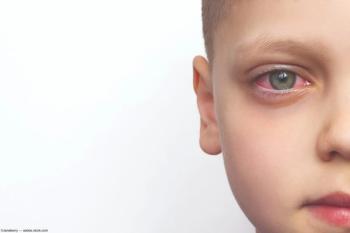 Young boy with inflamed eye Image credit: ©Janeberry - adobe.stock.com