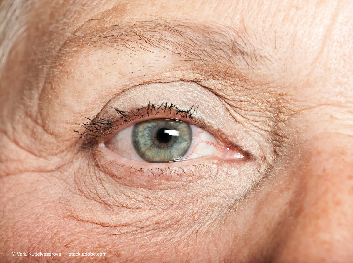 Image Credit: © Vera Kuttelvaserova - stock.adobe.com