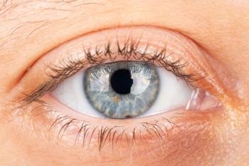Eyes with corneal dystrophy Image credit: AdobeStock/Fukume