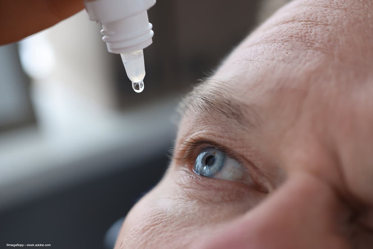 Man instills Miebo eye drops in eye affected by meibomian gland dysfunction (Image credit: Adobe Stock/megaflopp)