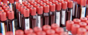Blood vials in lab Image credit: AdobeStock/SteffenKögler