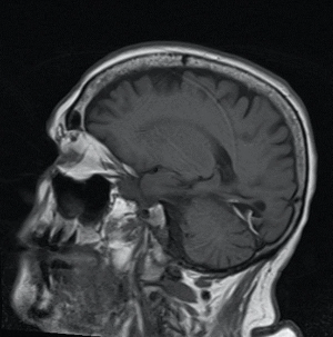ODs’ guide to MRIs
