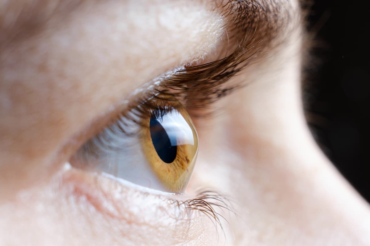 Closeup of keratoconic eye Image credit: AdobeStock/ZarinaLukash