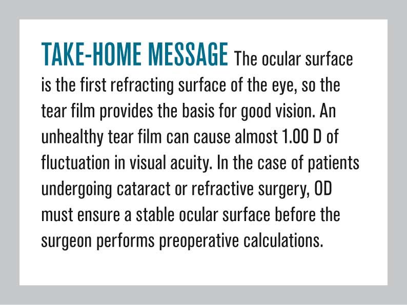 Prepping The Ocular Surface Before Surgery Prepping The Ocular Surface Before Surgery