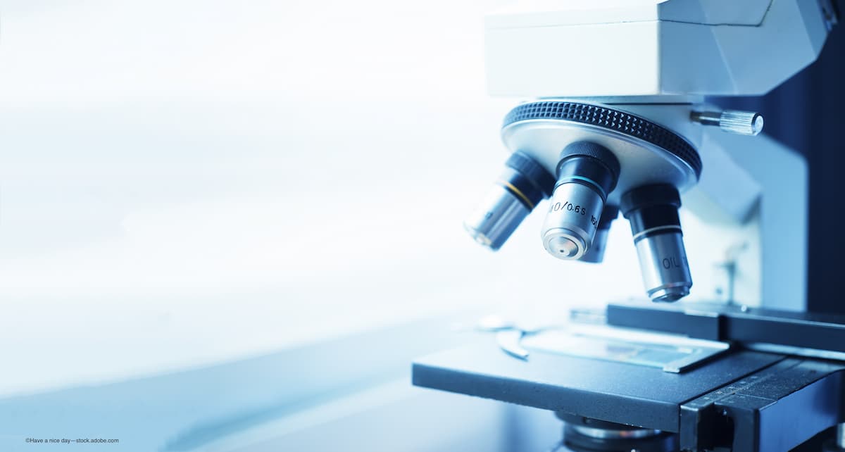 FDA accepts updated BLA from Outlook Therapeutics for ONS-5019 for wet AMD - Image credit: Adobe Stock / ©Have a nice day