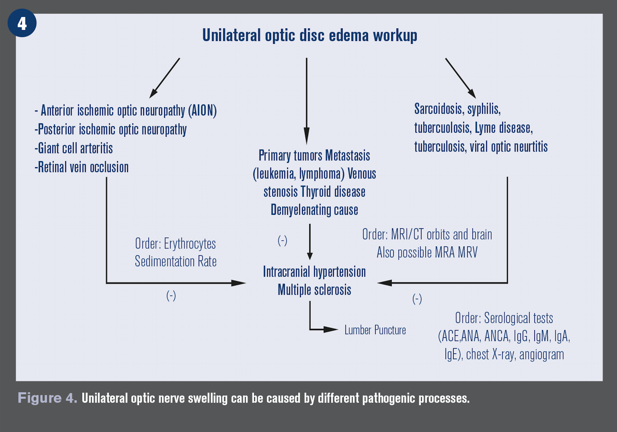 How To Diagnose A Swollen Optic Nerve