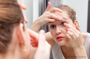 Scleral lens aids in visual rehabilitation