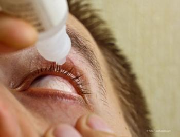 Aramis Biosciences doses first patient in phase 2 trial for DED treatment