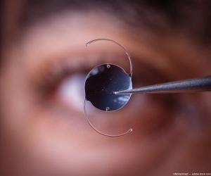 IOL held up in front of surgeon Image credit: AdobeStock/Mohammed