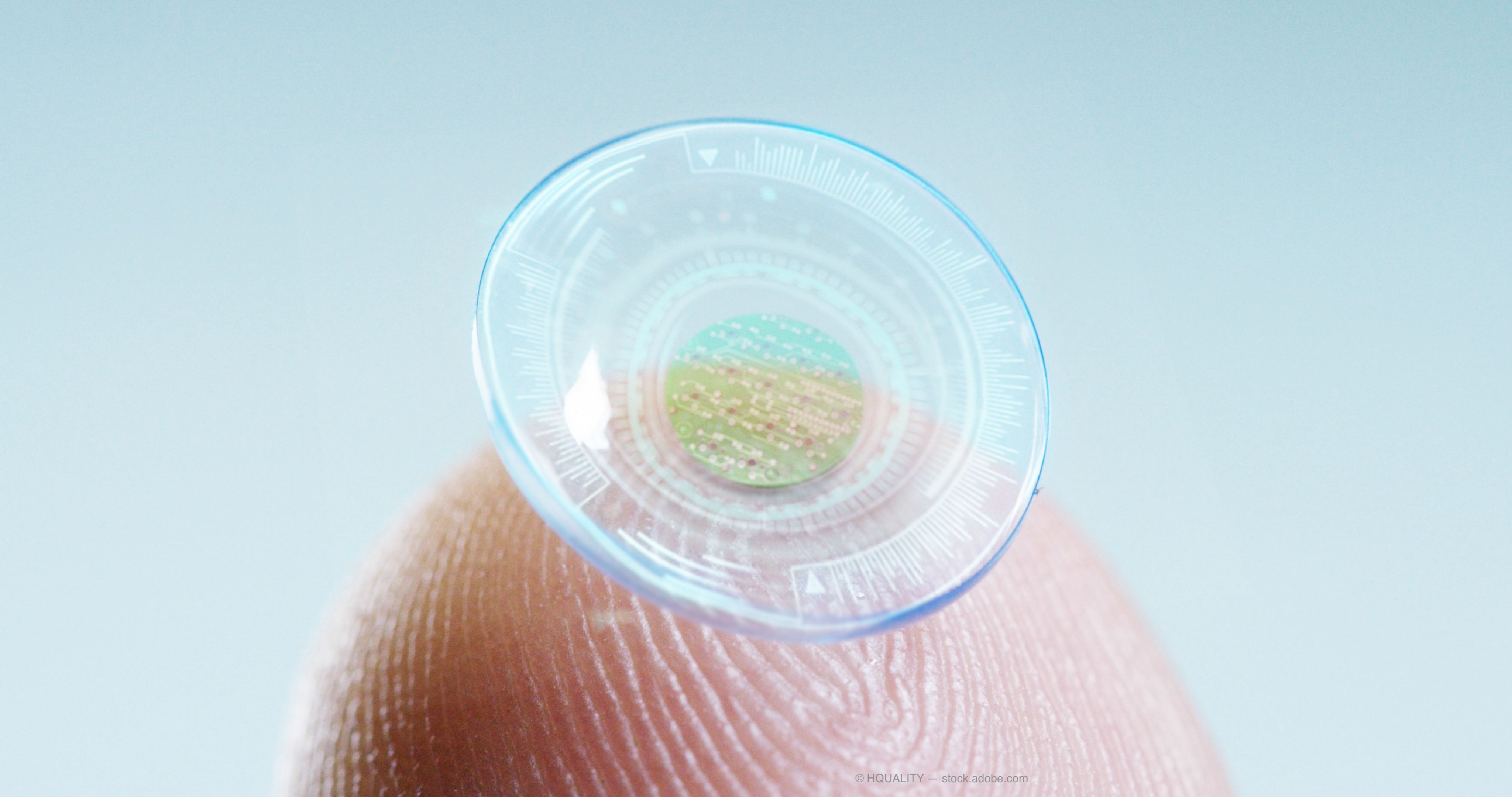 Researchers are investigating a 3D-printed self-moisturizing contact lens that could be a catalyst for the development of next-generation contact lens-based medical devices.