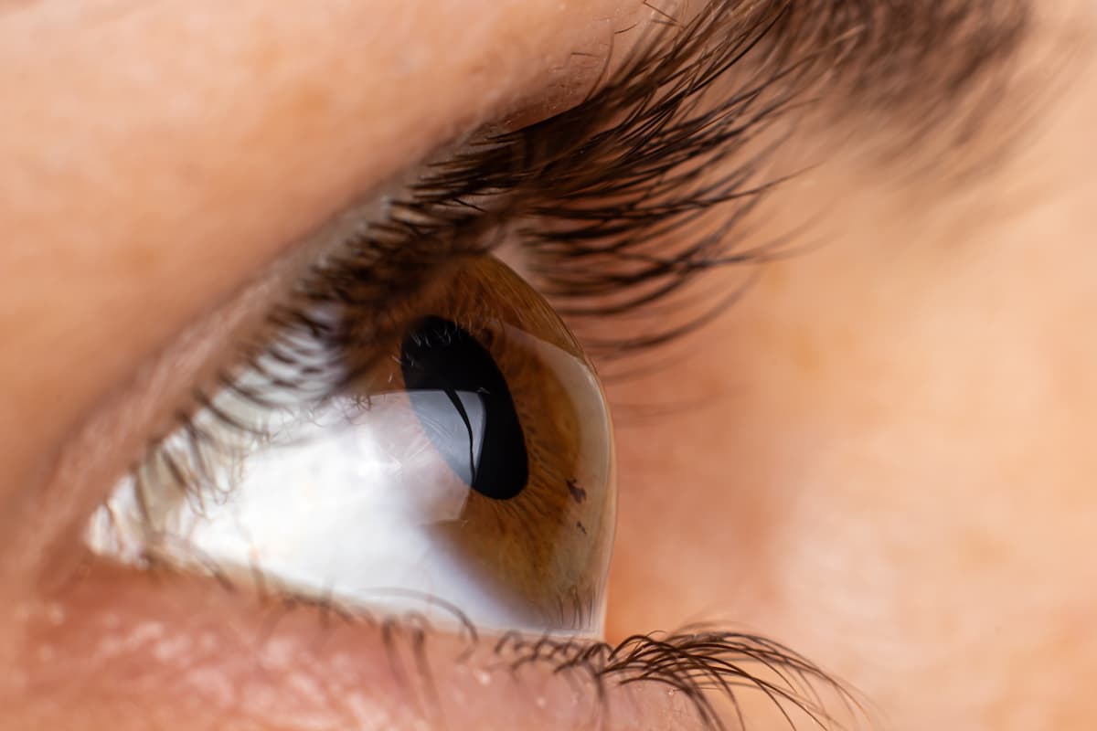 Closeup of keratoconic cornea Image credit: AdobeStock/ZarinaLukash