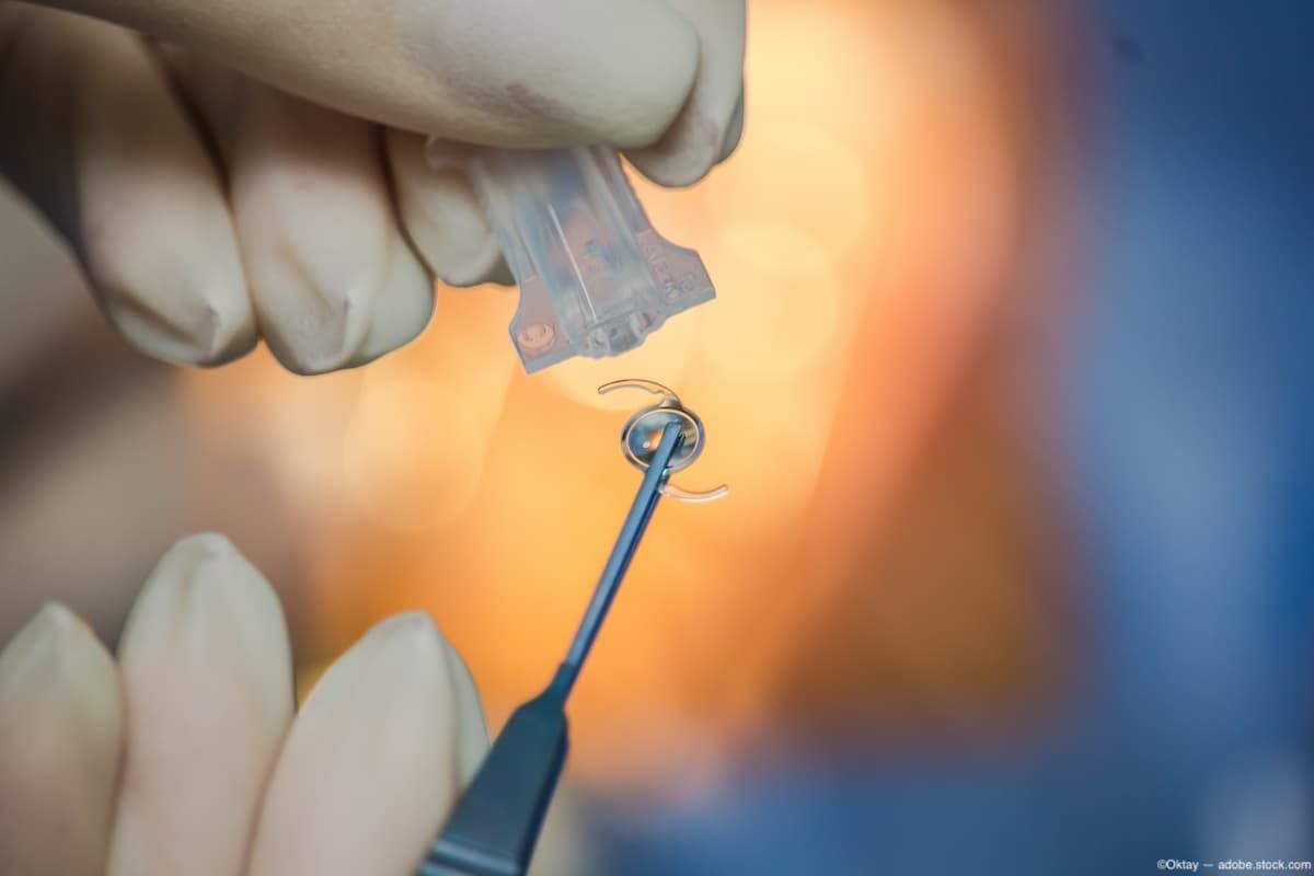 IOL being placed in container. Image credit: AdobeStock/Oktay