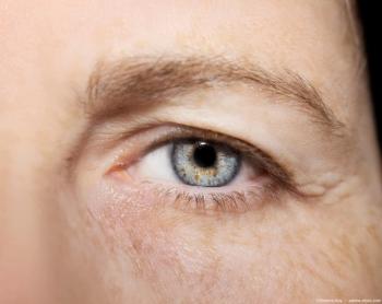 Closeup of eye Image credit: AdobeStock/VictoriaKey